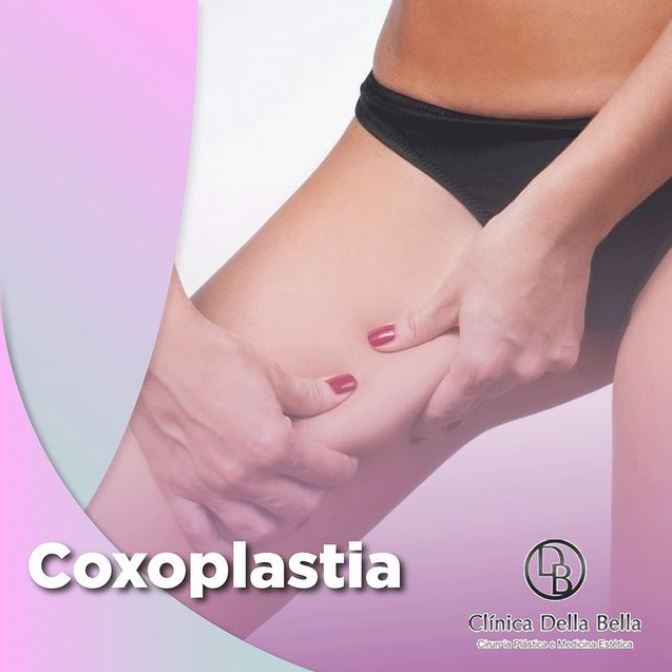 Coxoplastia
